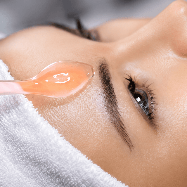 Acne Clarifying Program (9) at Skinclaire Aesthetics in Montebello, CA