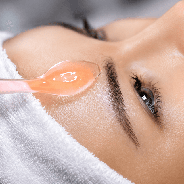 Acne Clarifying Program (6) at Skinclaire Aesthetics in Montebello, CA