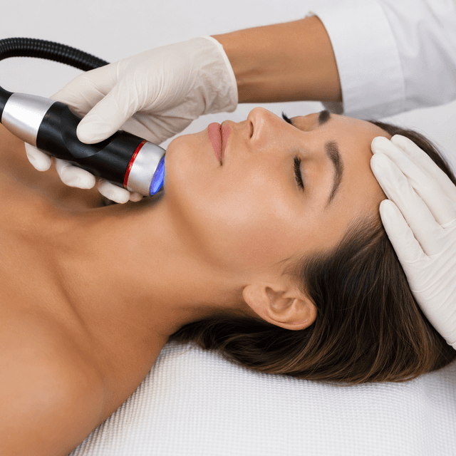 CryoLift + RF Program (6) at Skinclaire Aesthetics in Montebello, CA